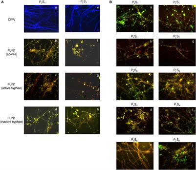 The Composition and Phosphorus Cycling Potential of Bacterial Communities Associated With Hyphae of Penicillium in Soil Are Strongly Affected by Soil Origin